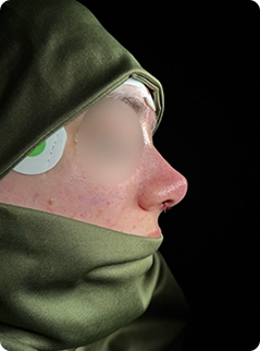 5-pic
